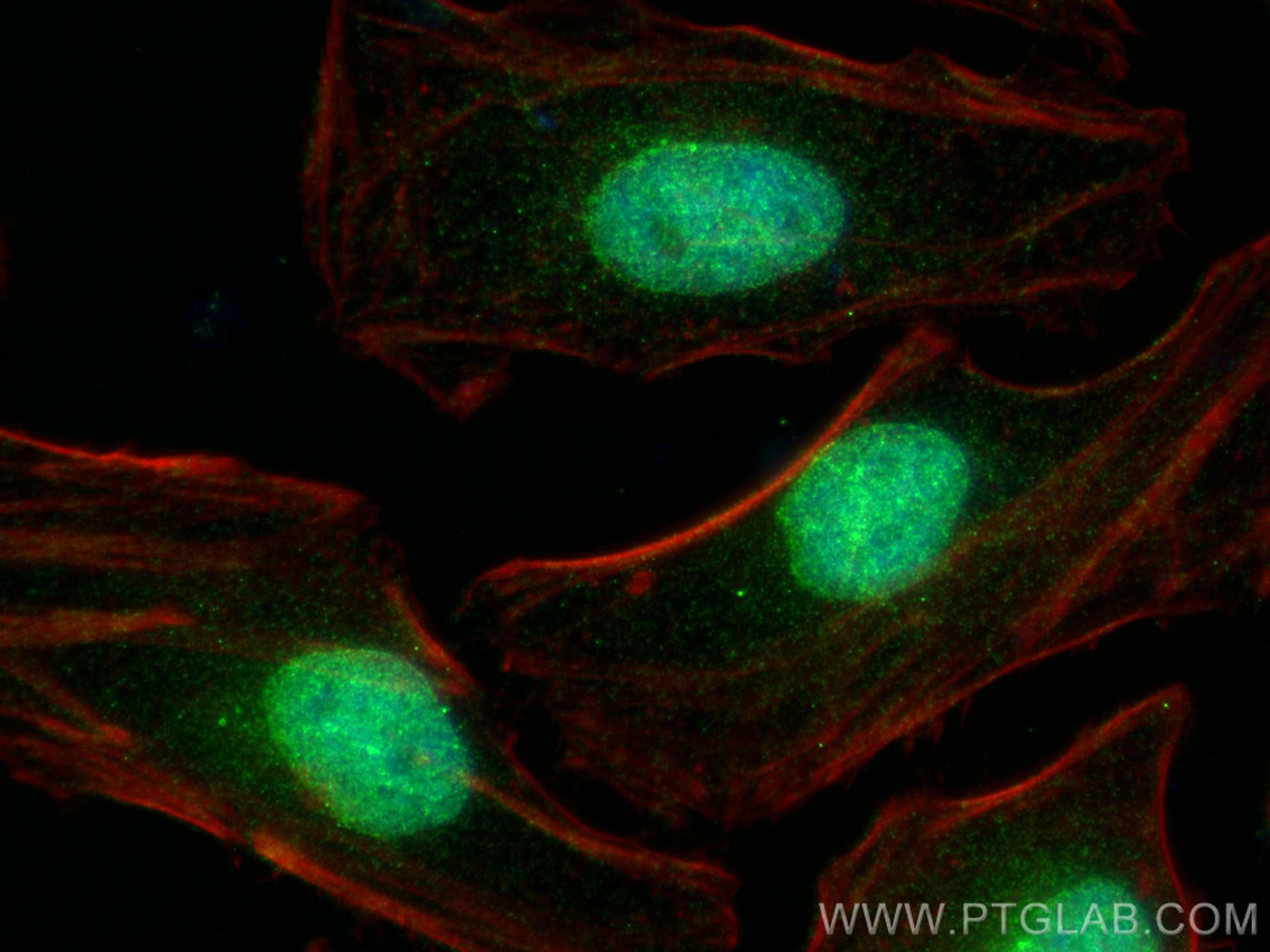 Immunofluorescence (IF) / fluorescent staining of HeLa cells using JMJD1C Polyclonal antibody (26637-1-AP)