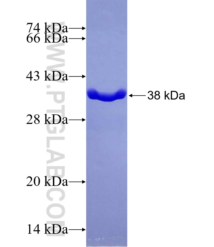 JMJD3 fusion protein Ag29559 SDS-PAGE