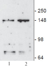 JMJD3/ KDM6B antibody (mAb) (Clone 67-A2) tested by Western blot. JMJD3/ KDM6B detection by Western blot. The analysis was performed using cell lysate from BJ cells (lane 1) and BJ cells irradiated (lane 2).