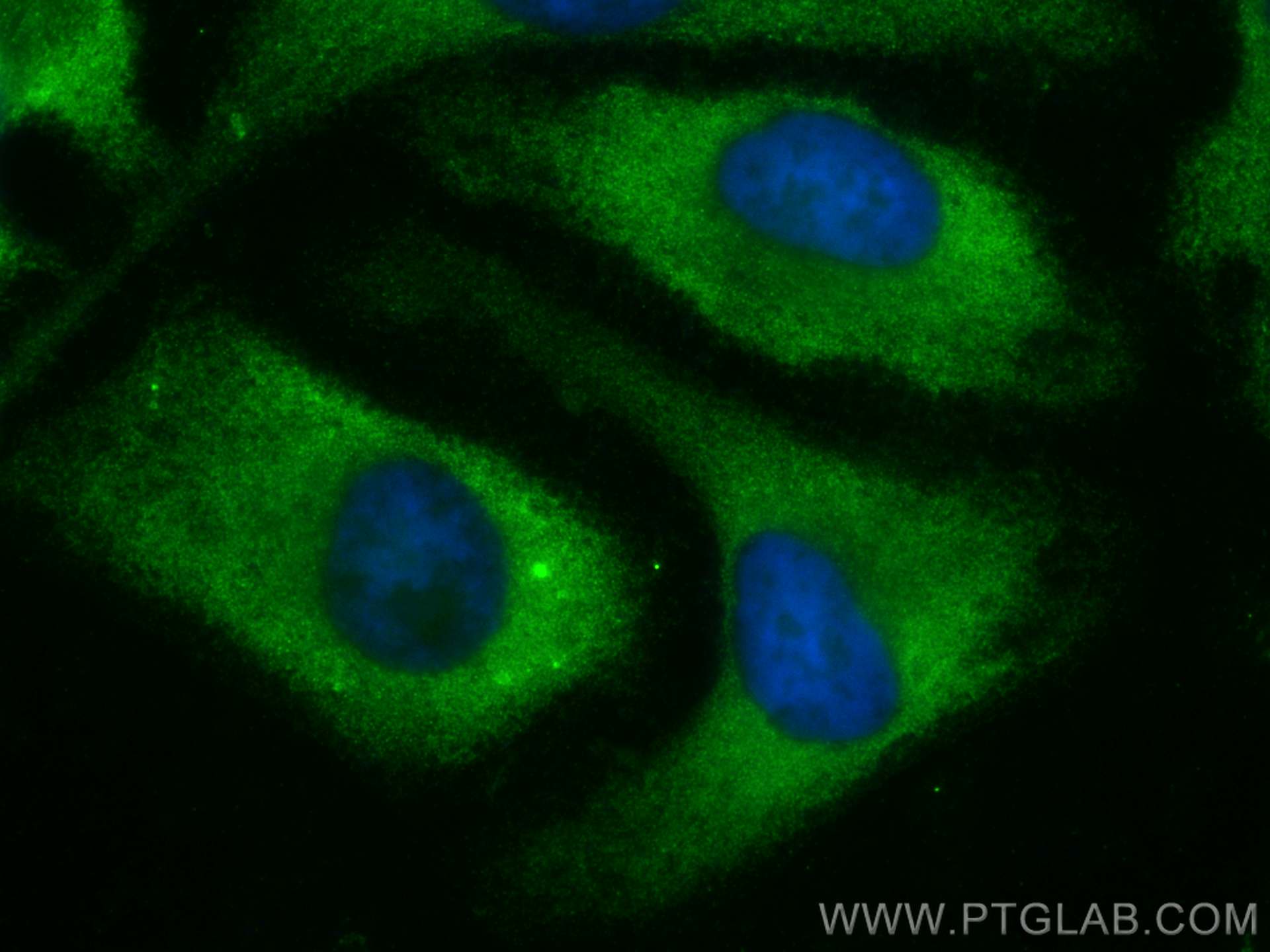 Immunofluorescence (IF) / fluorescent staining of HeLa cells using JMY Polyclonal antibody (25098-1-AP)