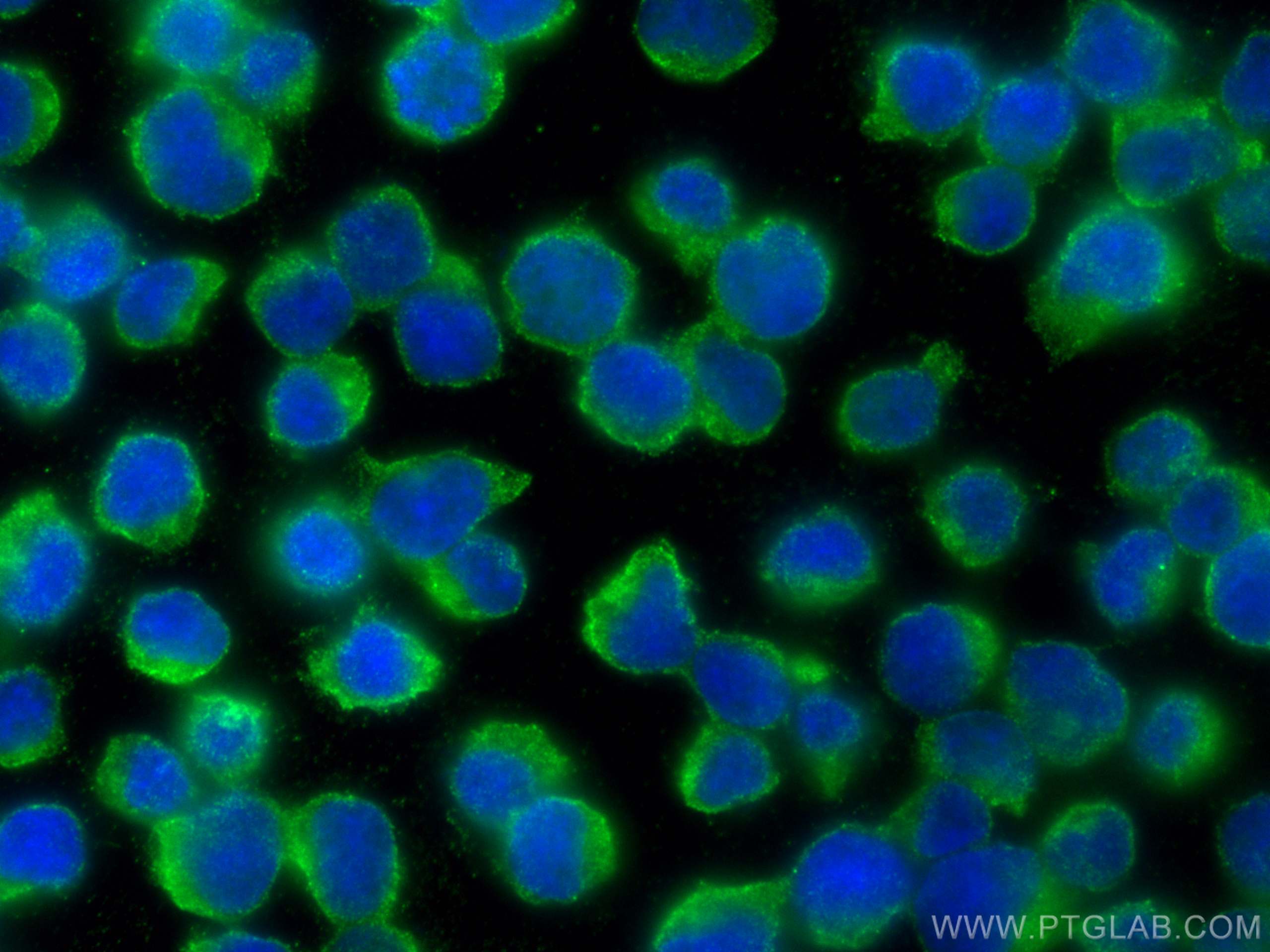 Immunofluorescence (IF) / fluorescent staining of Jurkat cells using JNK Monoclonal antibody (66210-1-Ig)