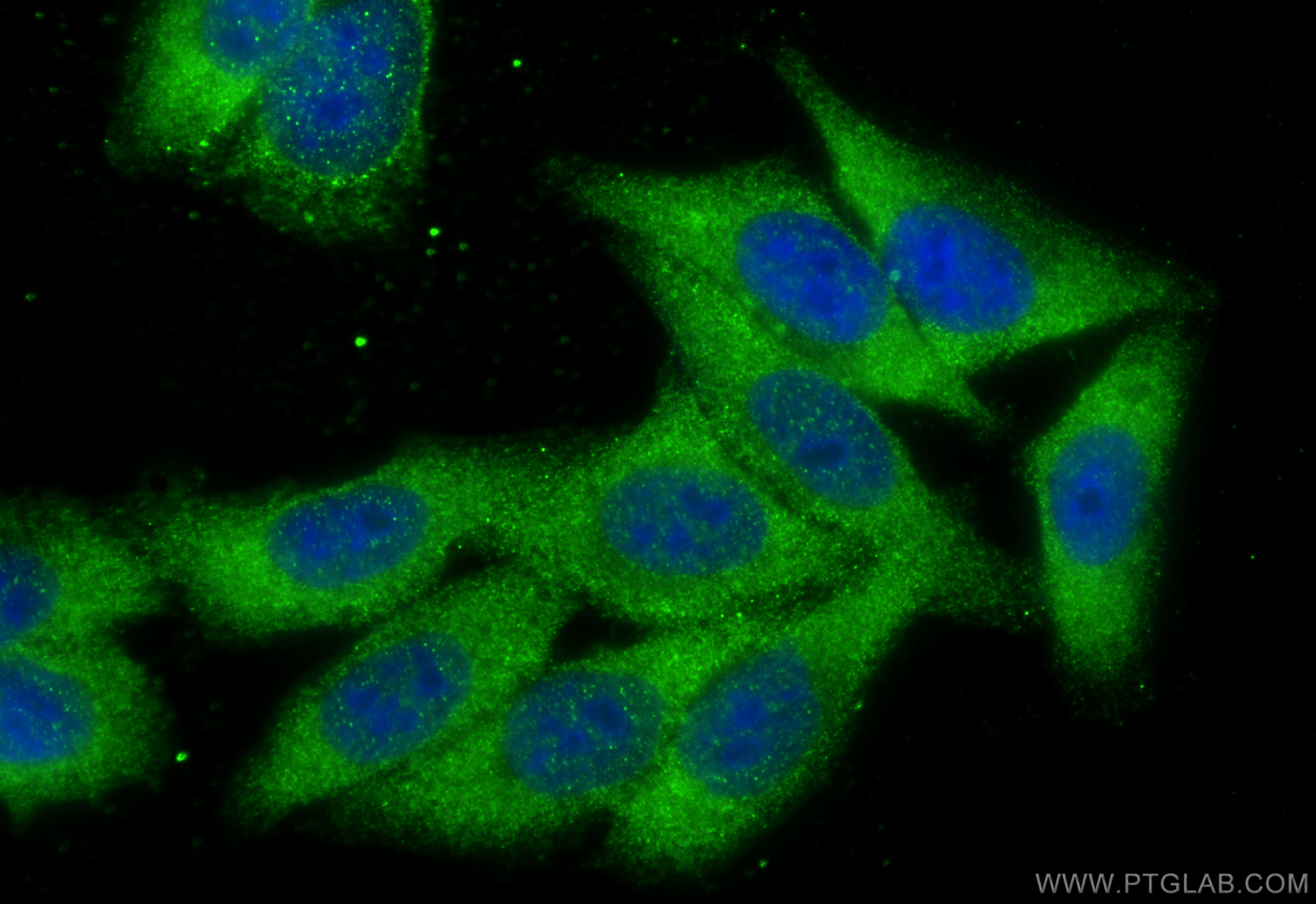 Immunofluorescence (IF) / fluorescent staining of HepG2 cells using JP45/JSRP1 Polyclonal antibody (10854-1-AP)