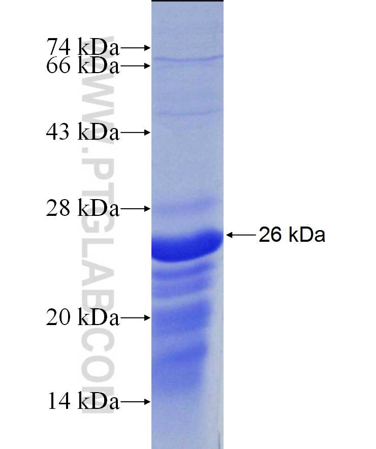 JUB fusion protein Ag29742 SDS-PAGE