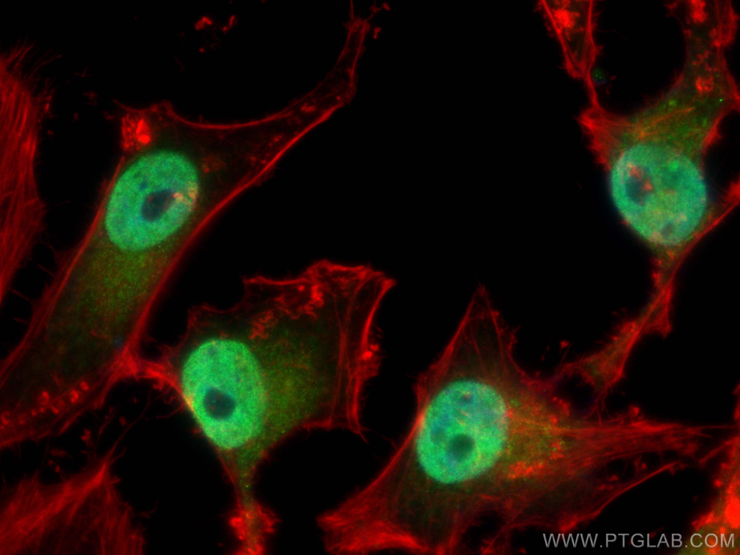 Immunofluorescence (IF) / fluorescent staining of HeLa cells using JUNB Polyclonal antibody (10486-1-AP)