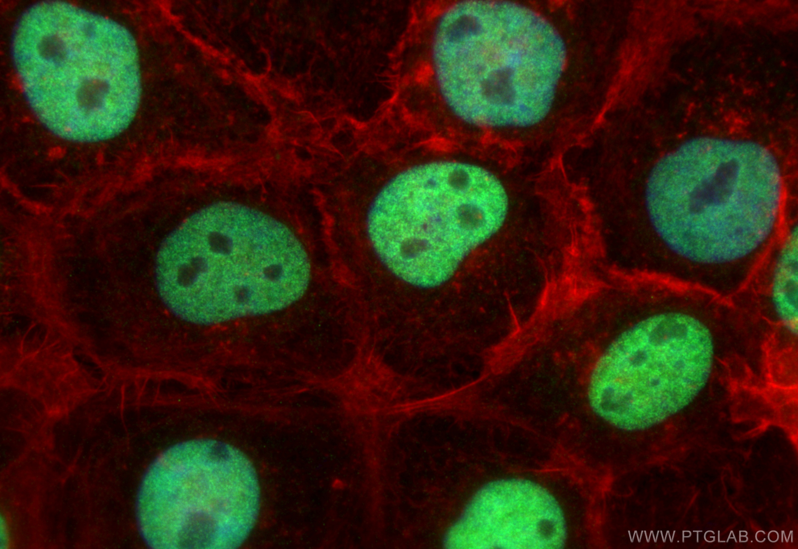 Immunofluorescence (IF) / fluorescent staining of A431 cells using JUNB Polyclonal antibody (10486-1-AP)