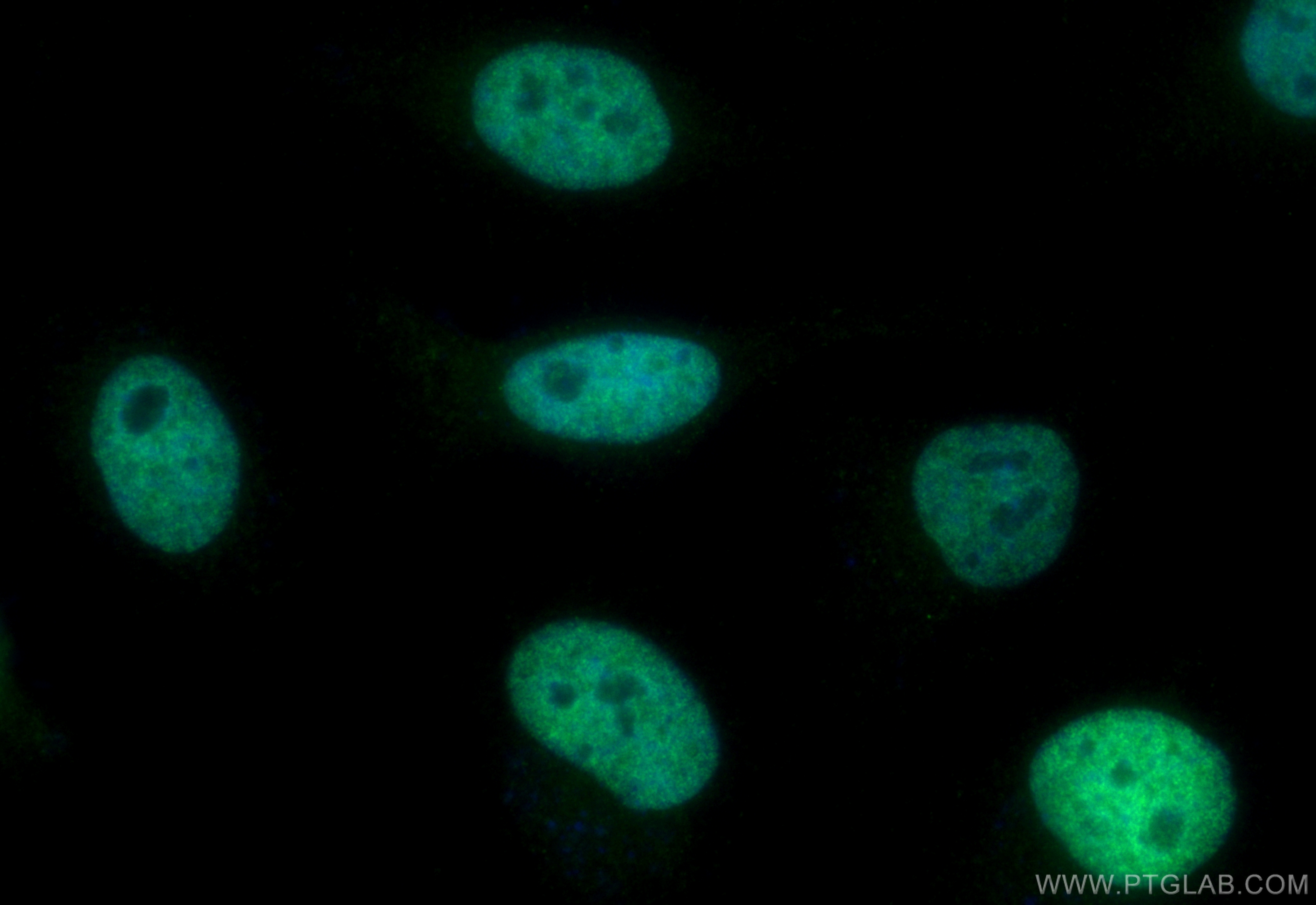 Immunofluorescence (IF) / fluorescent staining of HeLa cells using CoraLite® Plus 488-conjugated JUNB Polyclonal anti (CL488-10486)