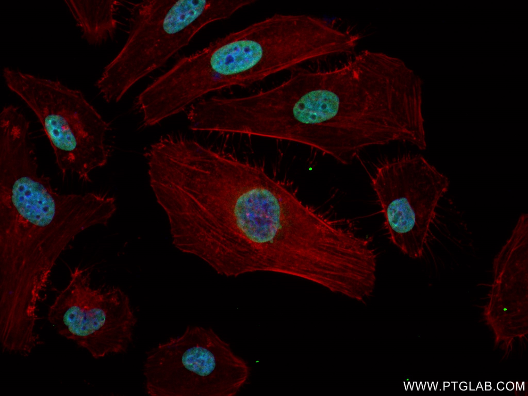 Immunofluorescence (IF) / fluorescent staining of HeLa cells using JUND Recombinant antibody (83134-6-RR)