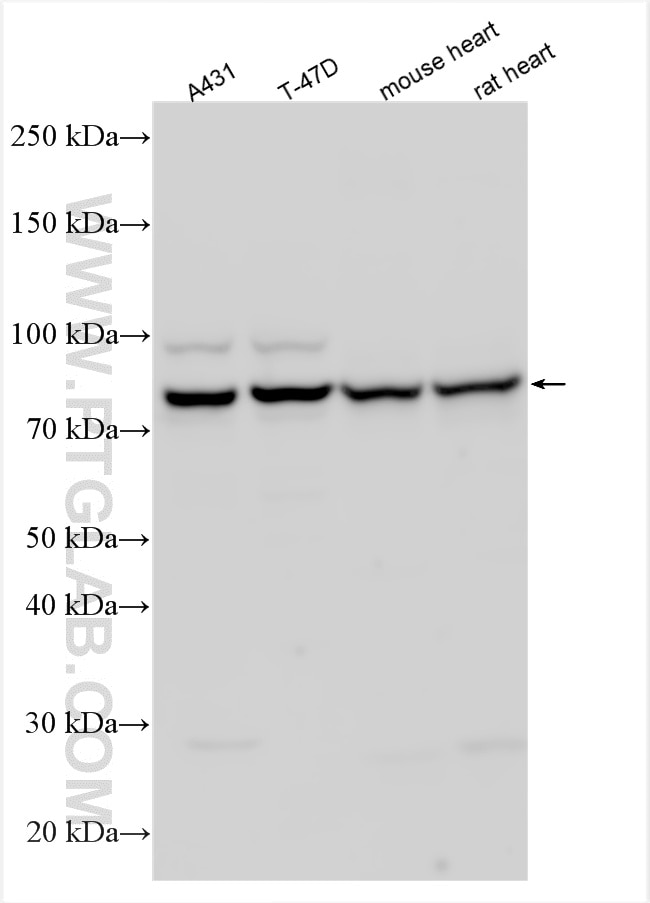 Western Blot (WB) analysis of various lysates using Gamma Catenin Polyclonal antibody (11146-1-AP)