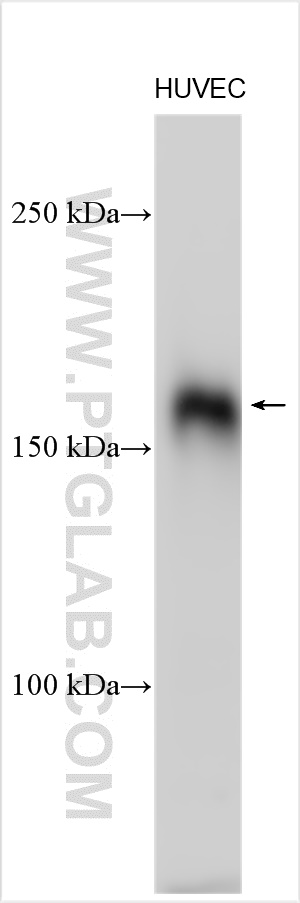 Western Blot (WB) analysis of various lysates using Jagged1 Polyclonal antibody (27767-1-AP)