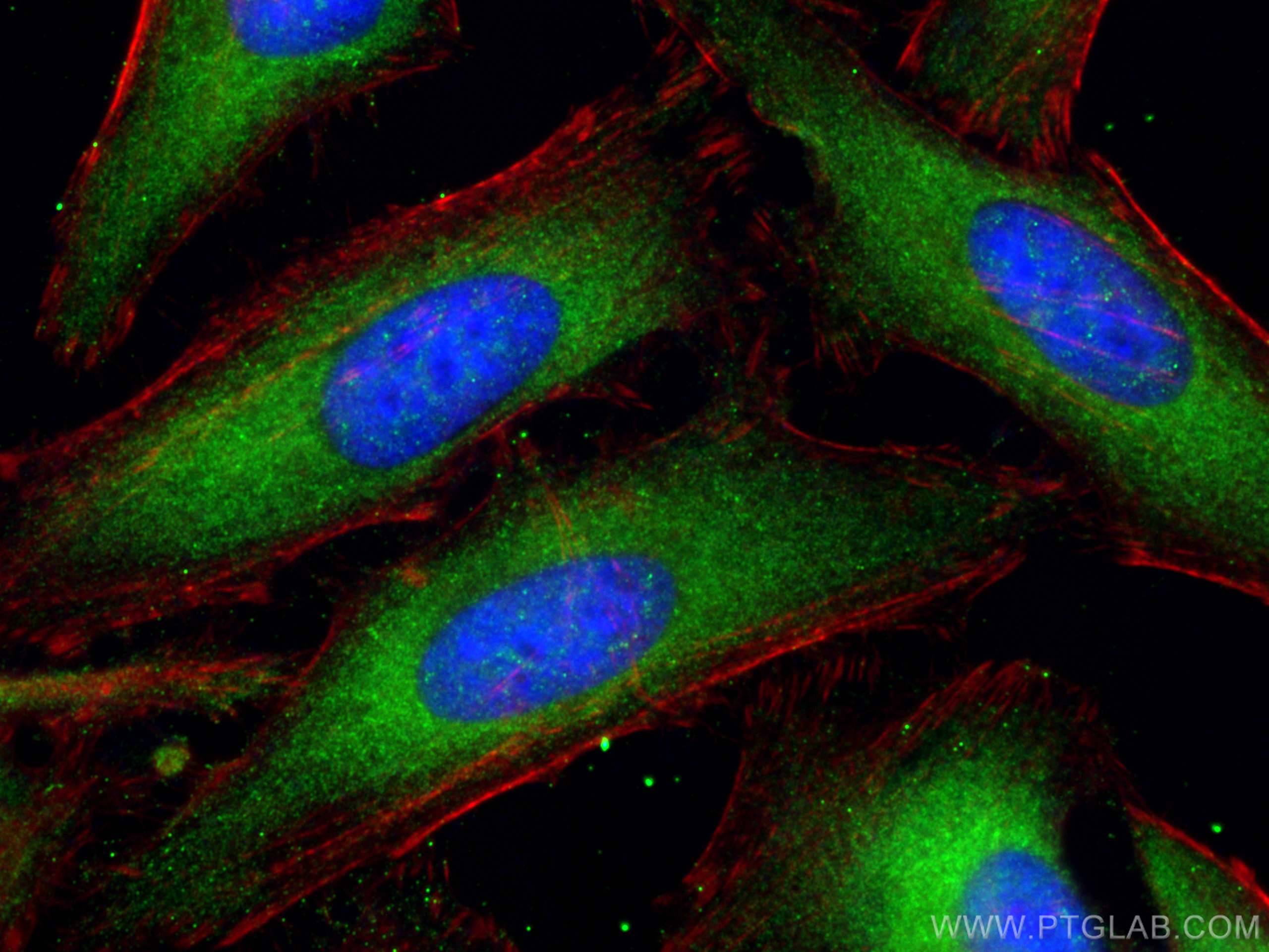 Immunofluorescence (IF) / fluorescent staining of HeLa cells using KANK2 Polyclonal antibody (20546-1-AP)