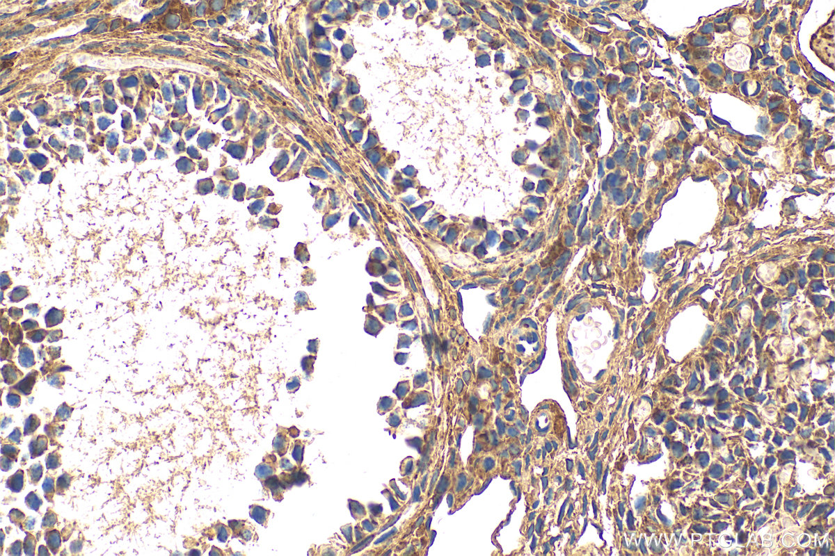 Immunohistochemistry (IHC) staining of mouse ovary tissue using KANK2 Polyclonal antibody (20546-1-AP)