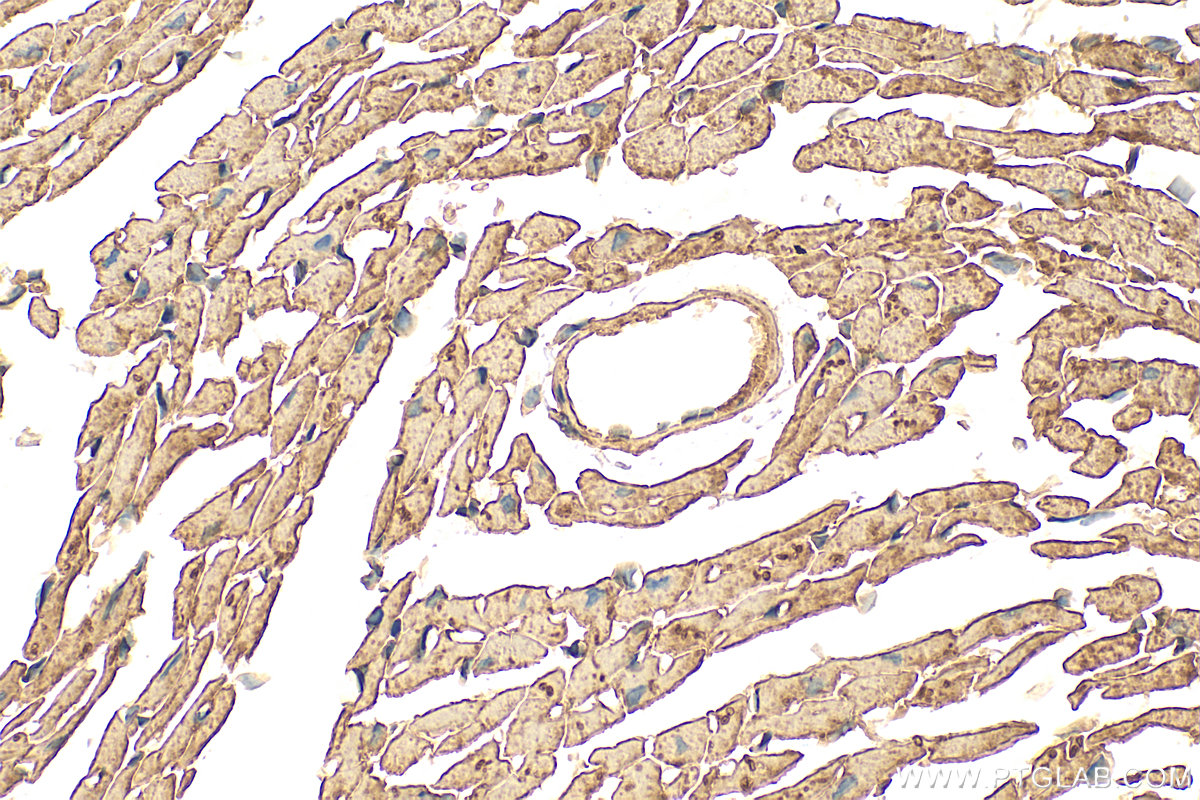 Immunohistochemistry (IHC) staining of mouse heart tissue using KANK2 Polyclonal antibody (20546-1-AP)