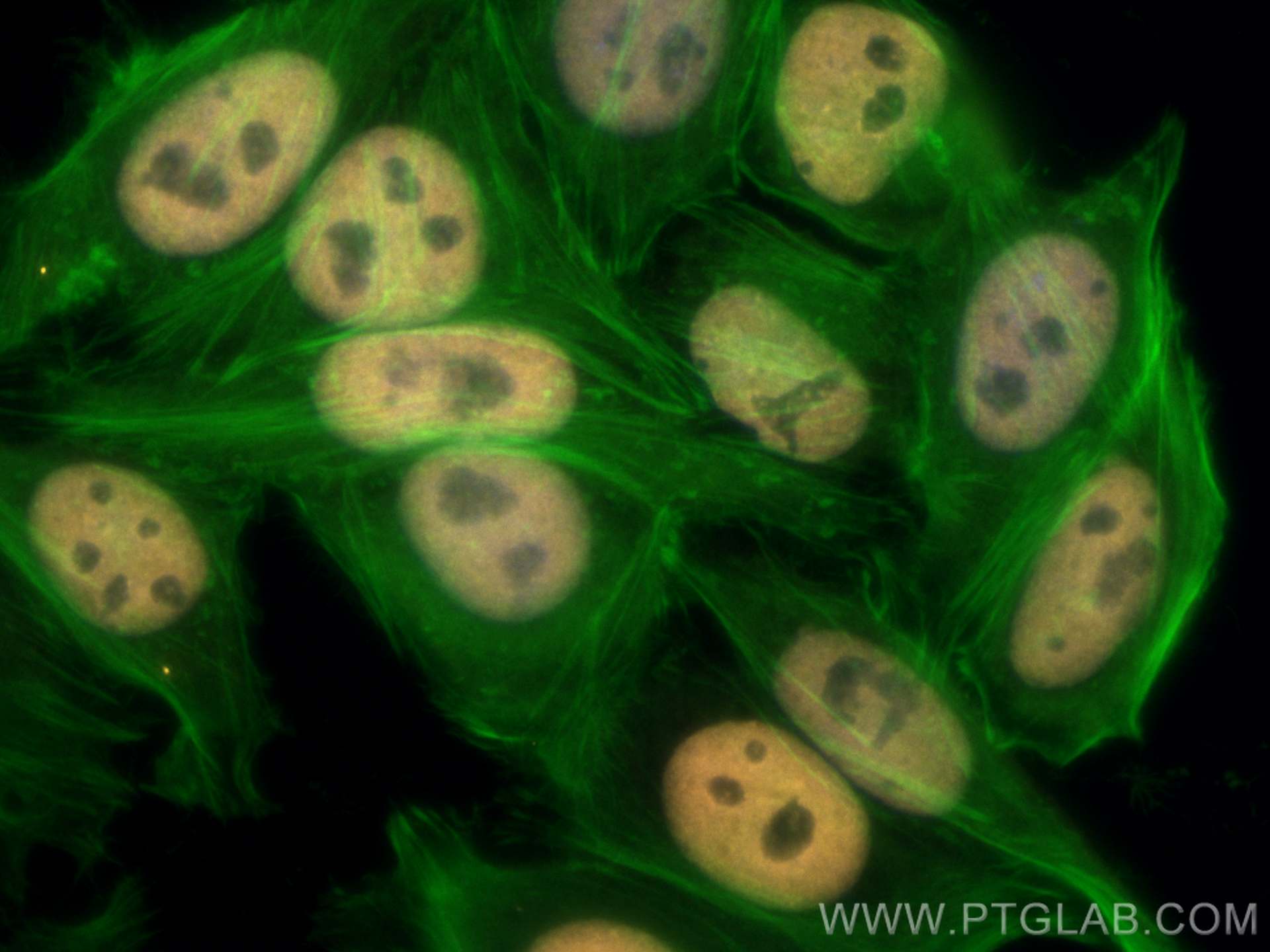 Immunofluorescence (IF) / fluorescent staining of HepG2 cells using CoraLite®555-conjugated KAP1 Monoclonal antibody (CL555-66630)