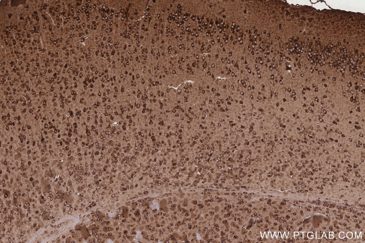 Immunohistochemistry (IHC) staining of mouse brain tissue using KARS Polyclonal antibody (14951-1-AP)