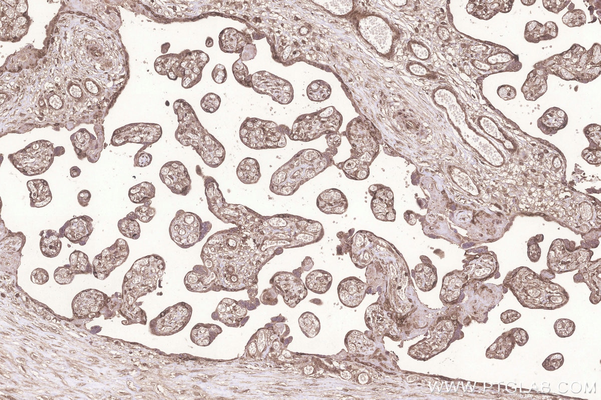 Immunohistochemistry (IHC) staining of human placenta tissue using KARS Polyclonal antibody (14951-1-AP)