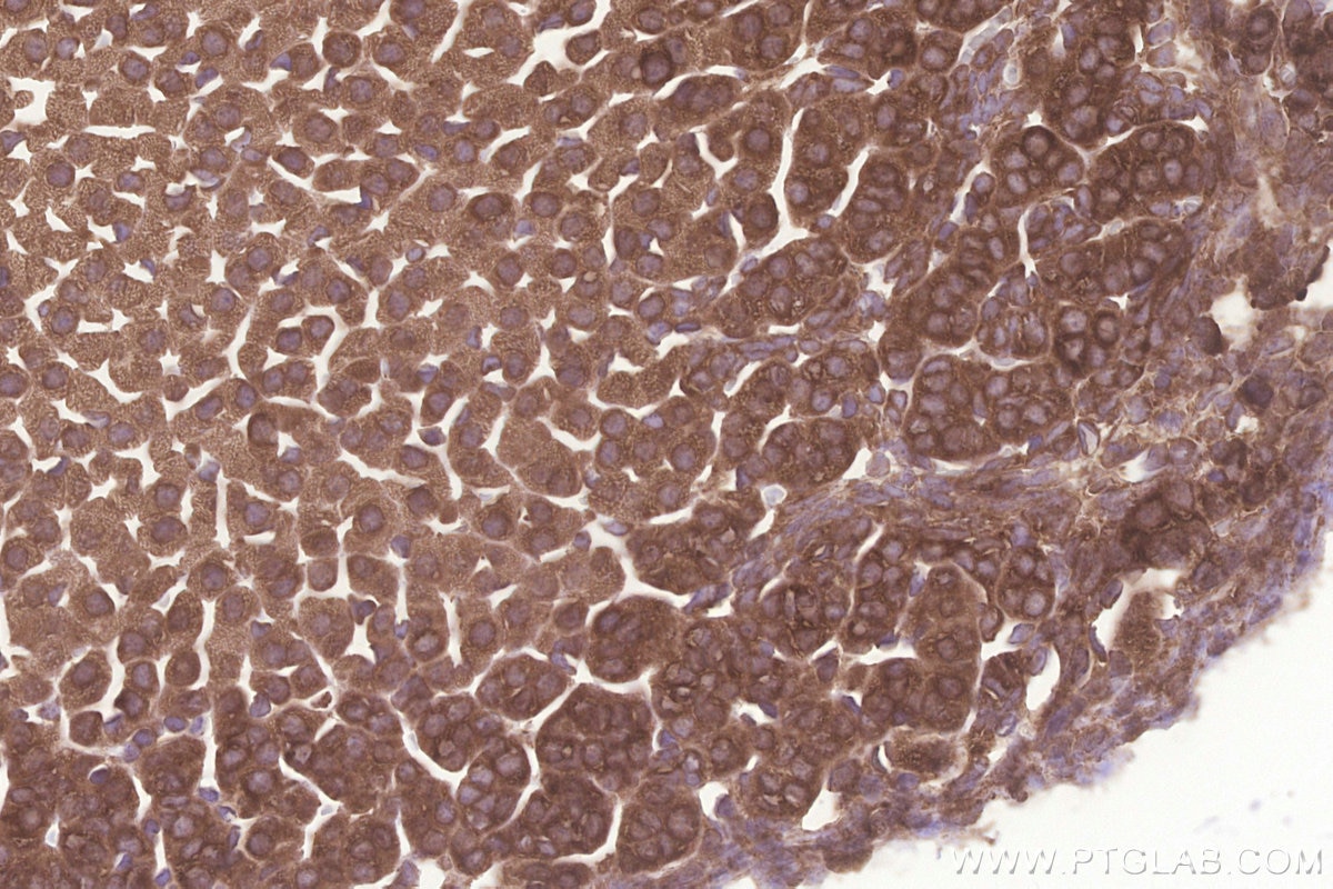 Immunohistochemistry (IHC) staining of mouse adrenal gland tissue using KARS Polyclonal antibody (14951-1-AP)