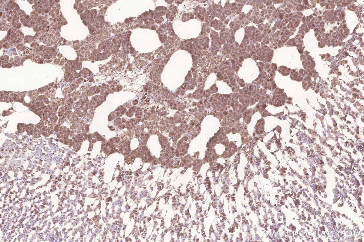 Immunohistochemistry (IHC) staining of rat adrenal gland tissue using KARS Polyclonal antibody (14951-1-AP)