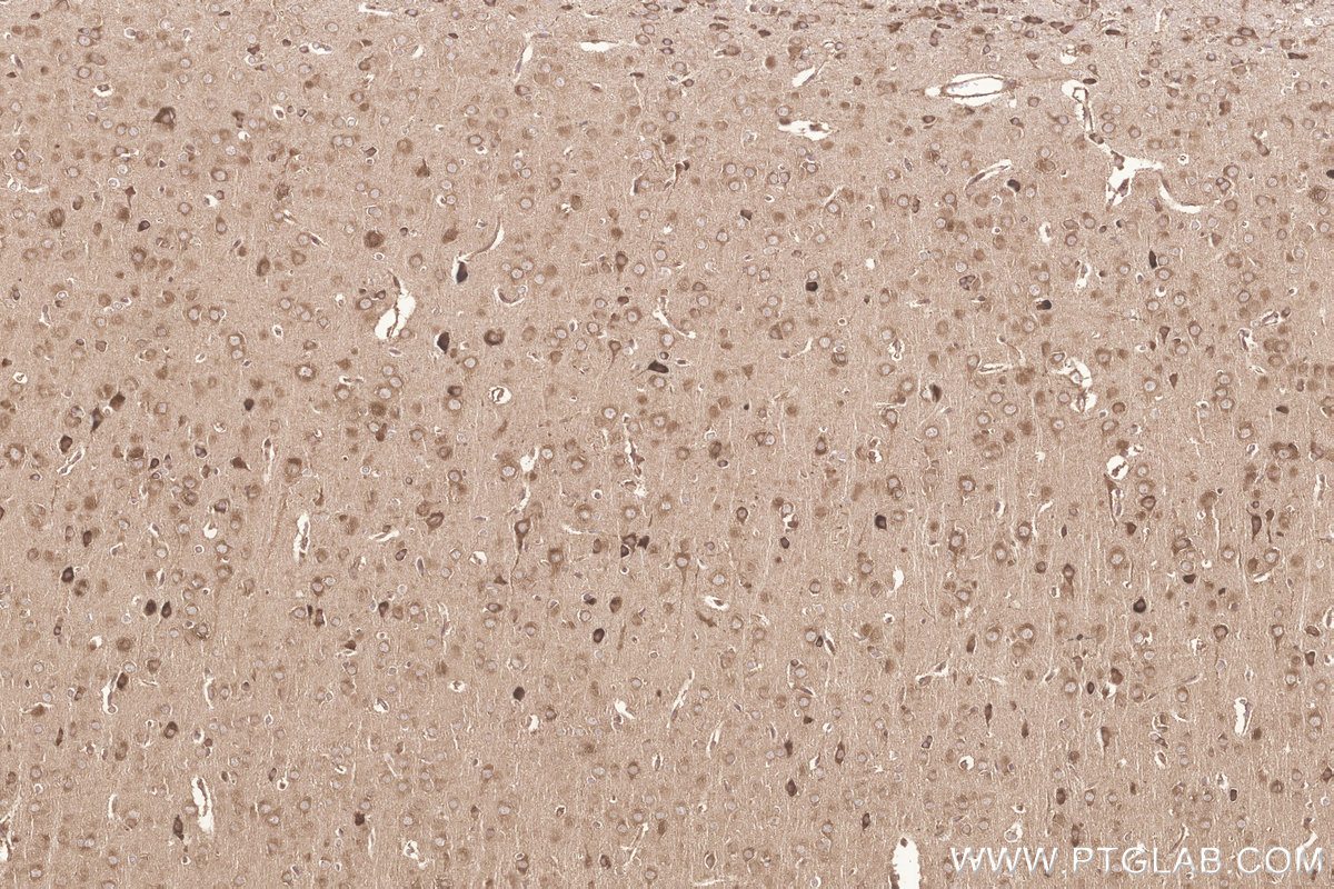 Immunohistochemistry (IHC) staining of rat brain tissue using KARS Polyclonal antibody (14951-1-AP)