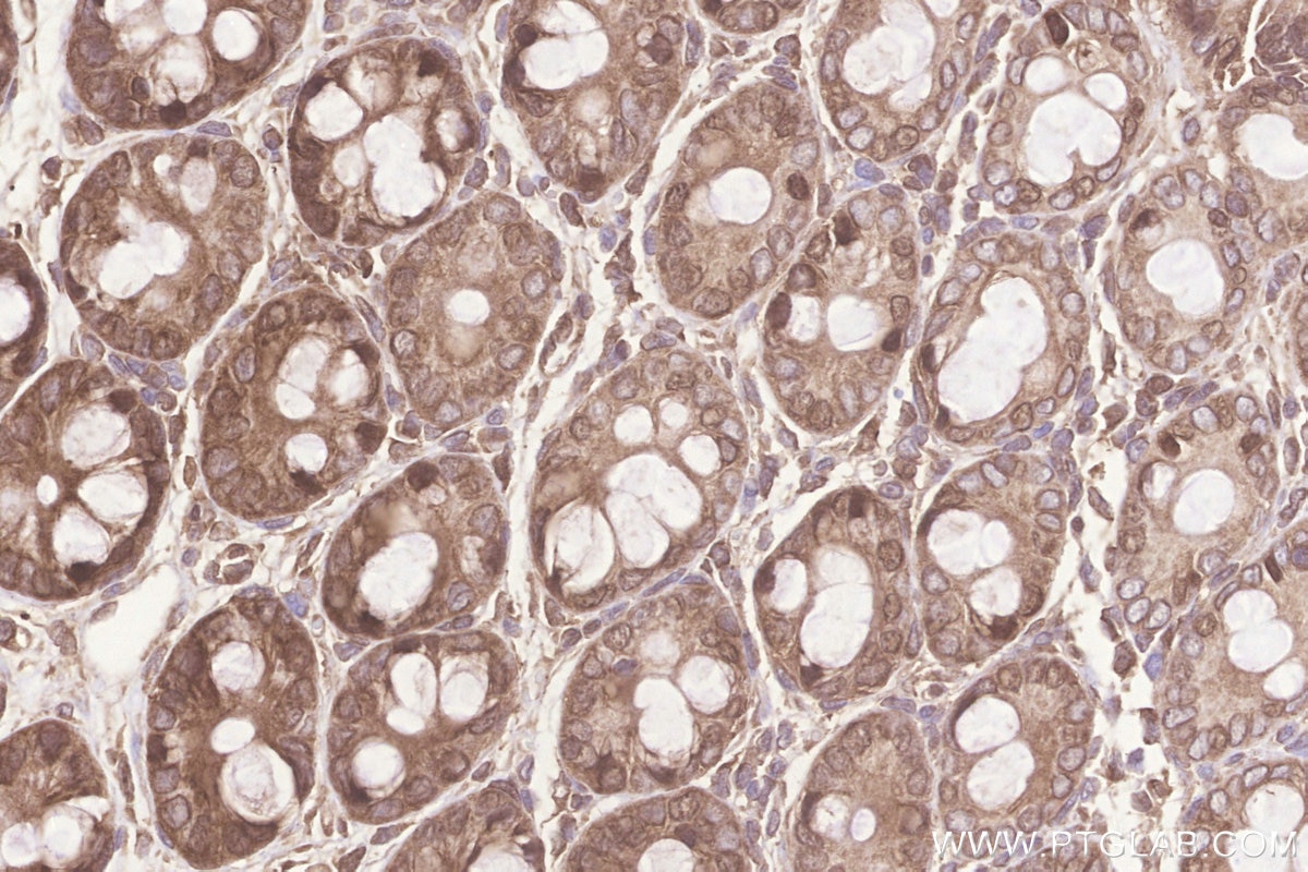 Immunohistochemistry (IHC) staining of rat colon tissue using KARS Polyclonal antibody (14951-1-AP)