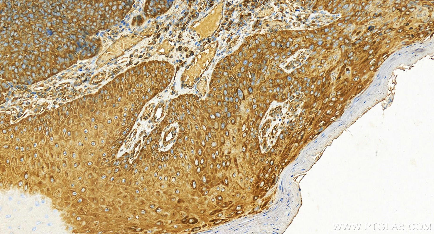 Immunohistochemistry (IHC) staining of human brown disease using KARS Polyclonal antibody (14951-1-AP)