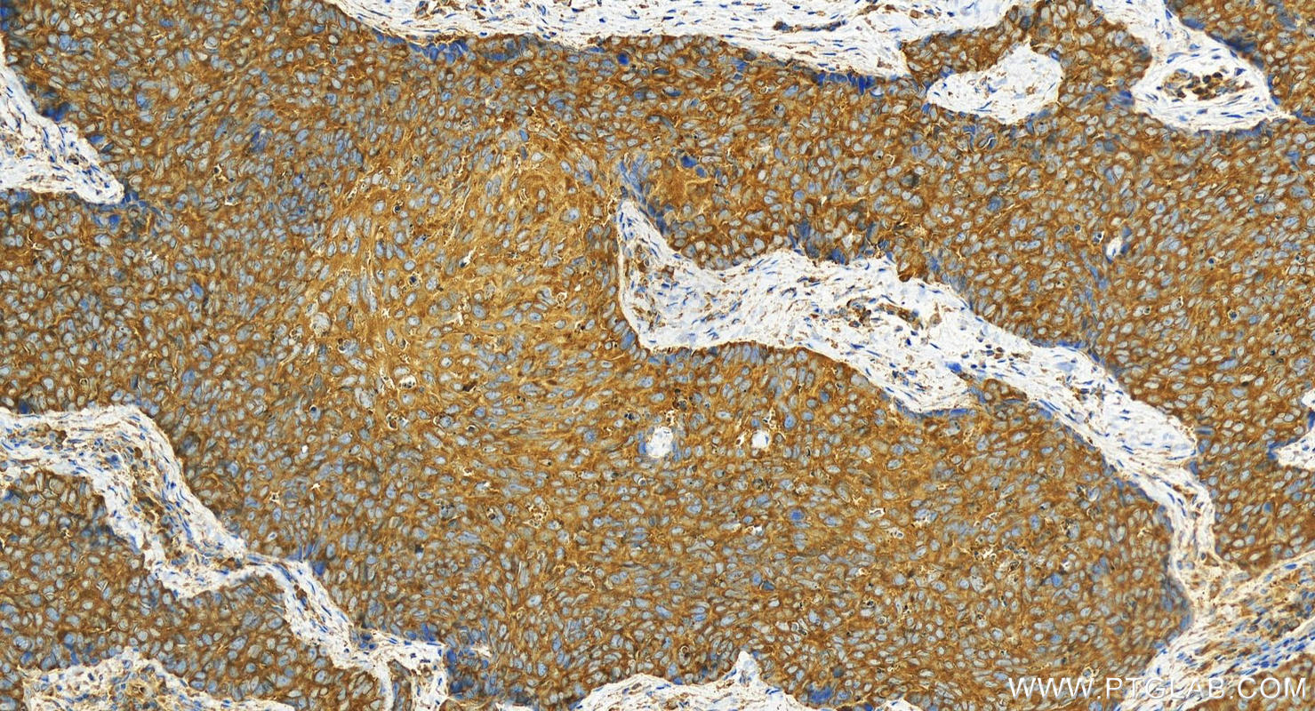 Immunohistochemistry (IHC) staining of human brown disease using KARS Polyclonal antibody (14951-1-AP)