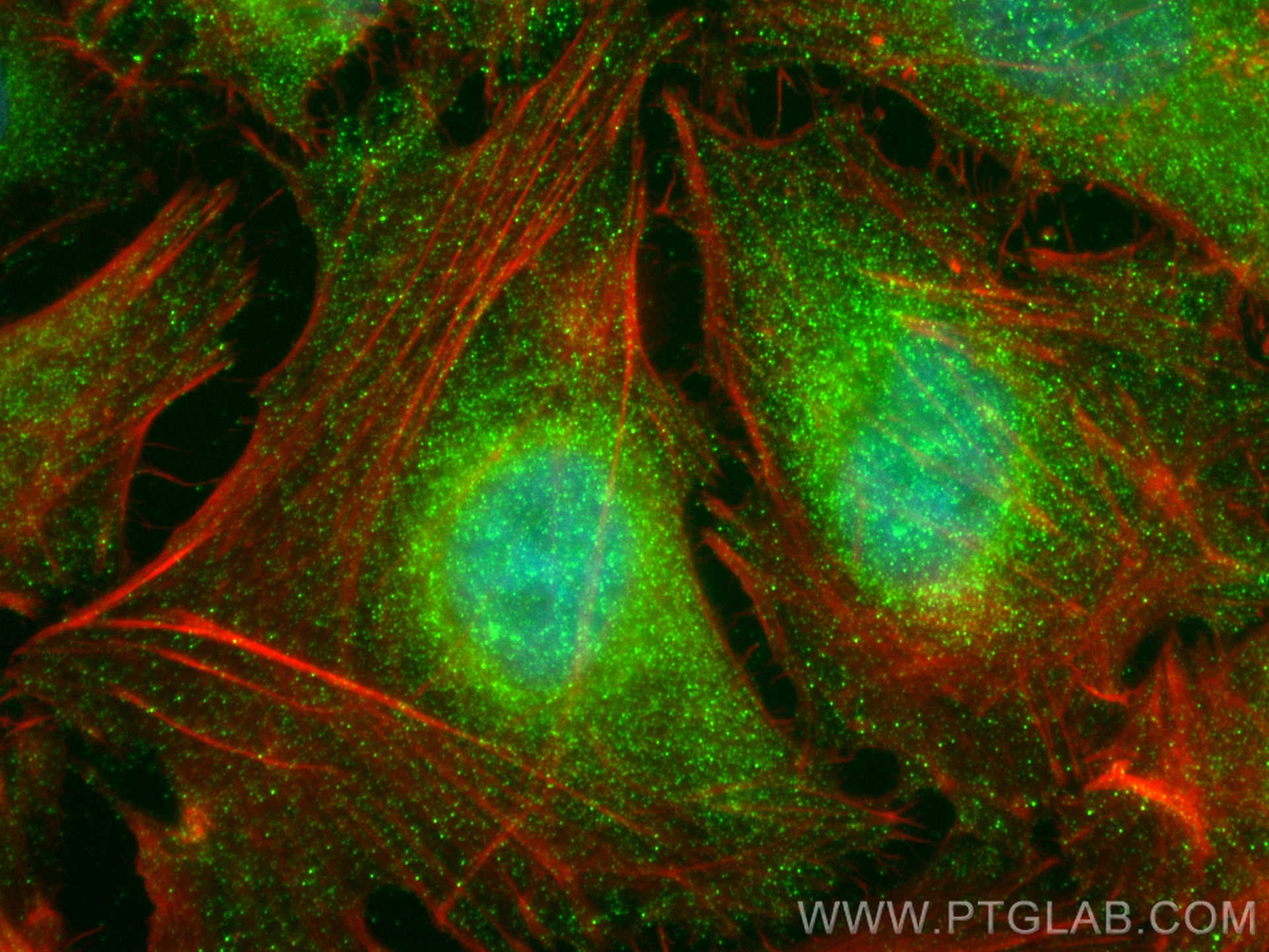 Immunofluorescence (IF) / fluorescent staining of HeLa cells using KAT2A/GCN5 Polyclonal antibody (28390-1-AP)
