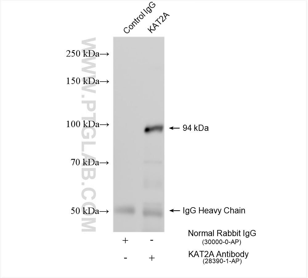 Immunoprecipitation (IP) experiment of hTERT-RPE1 cells using KAT2A Polyclonal antibody (28390-1-AP)
