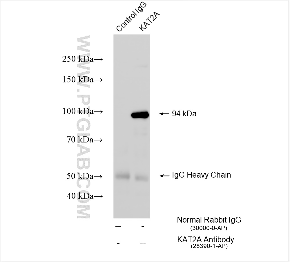Immunoprecipitation (IP) experiment of HEK-293T cells using KAT2A/GCN5 Polyclonal antibody (28390-1-AP)