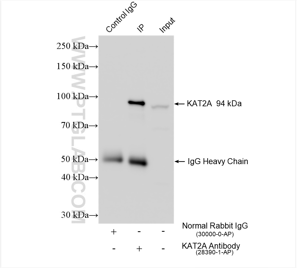 Immunoprecipitation (IP) experiment of LNCaP cells using KAT2A/GCN5 Polyclonal antibody (28390-1-AP)