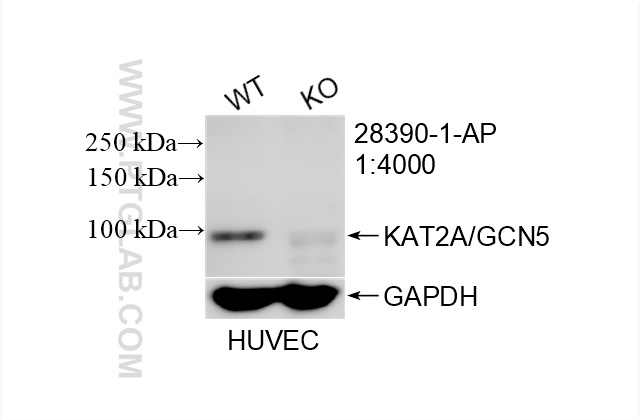 Western Blot (WB) analysis of HUVEC cells using KAT2A/GCN5 Polyclonal antibody (28390-1-AP)