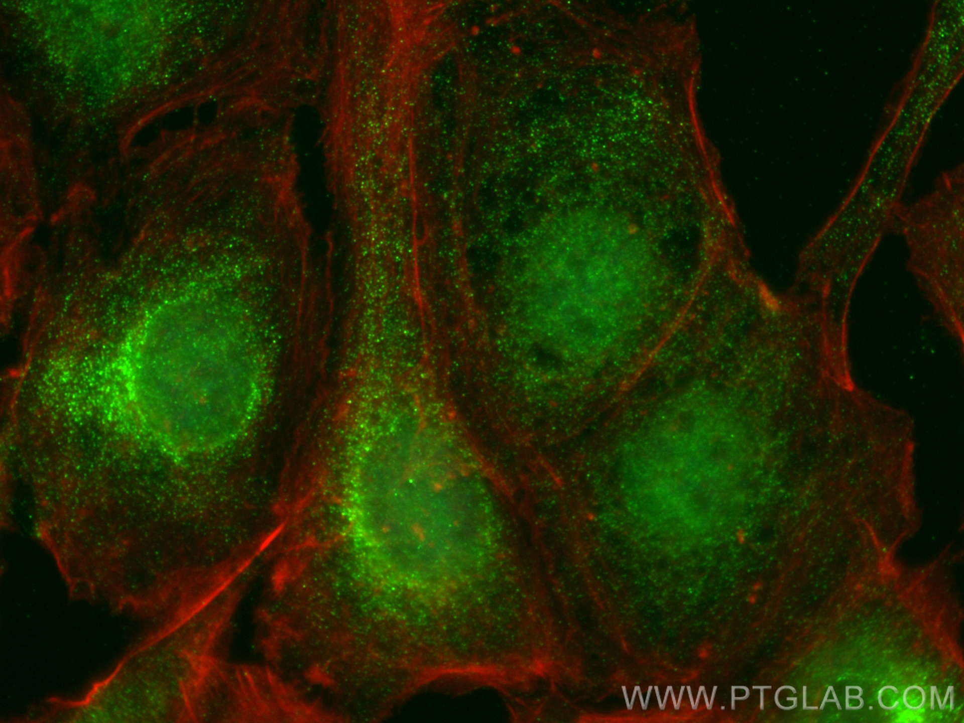 Immunofluorescence (IF) / fluorescent staining of SKOV-3 cells using KAT2A/GCN5 Monoclonal antibody (66575-1-Ig)