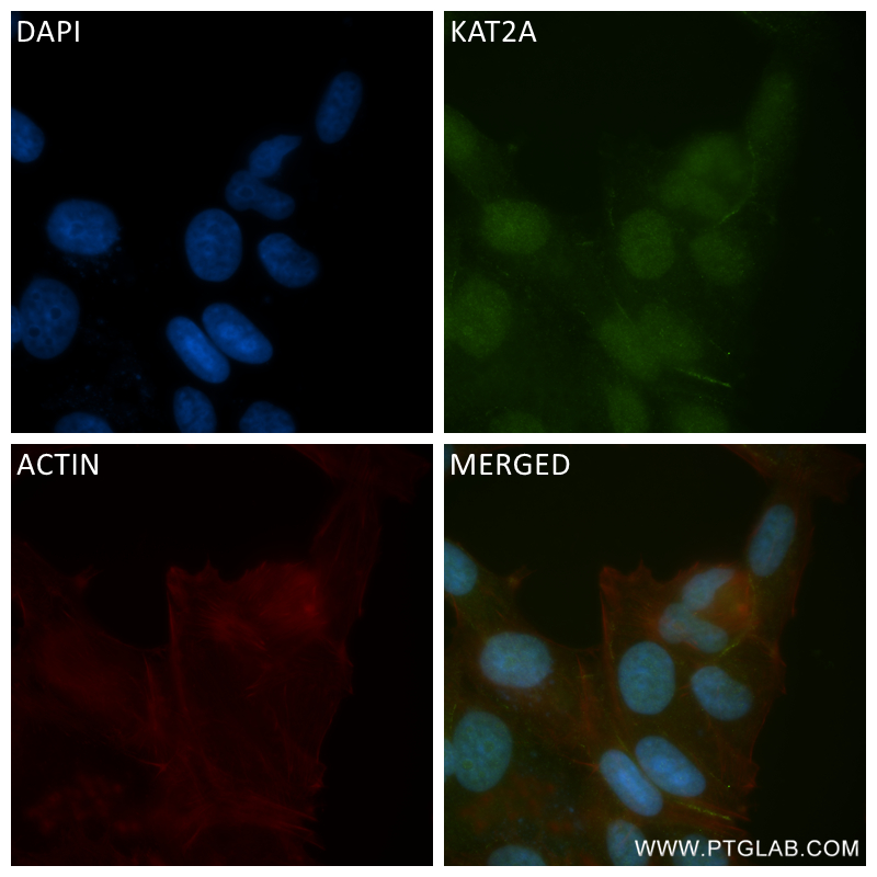 Immunofluorescence (IF) / fluorescent staining of MCF-7 cells using KAT2A/GCN5 Recombinant antibody (84669-2-RR)