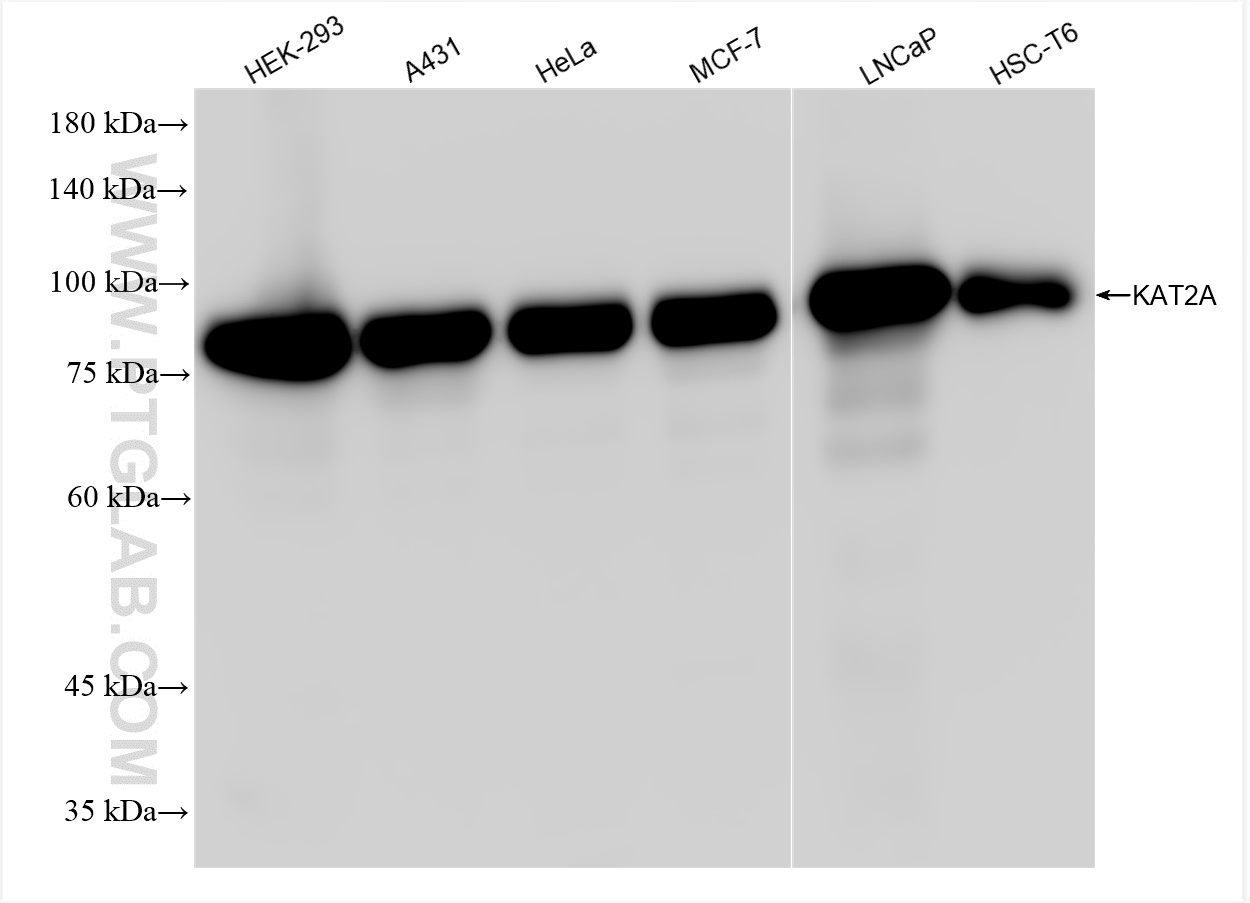 Western Blot (WB) analysis of various lysates using KAT2A/GCN5 Recombinant antibody (84669-2-RR)