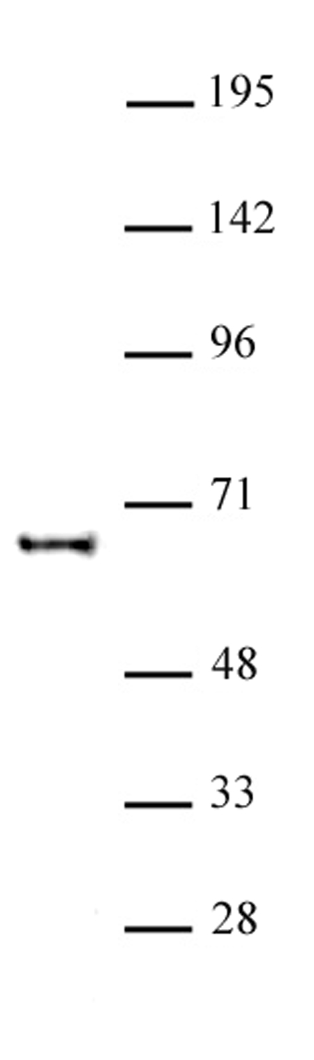 KAT5 antibody (pAb) | Proteintech