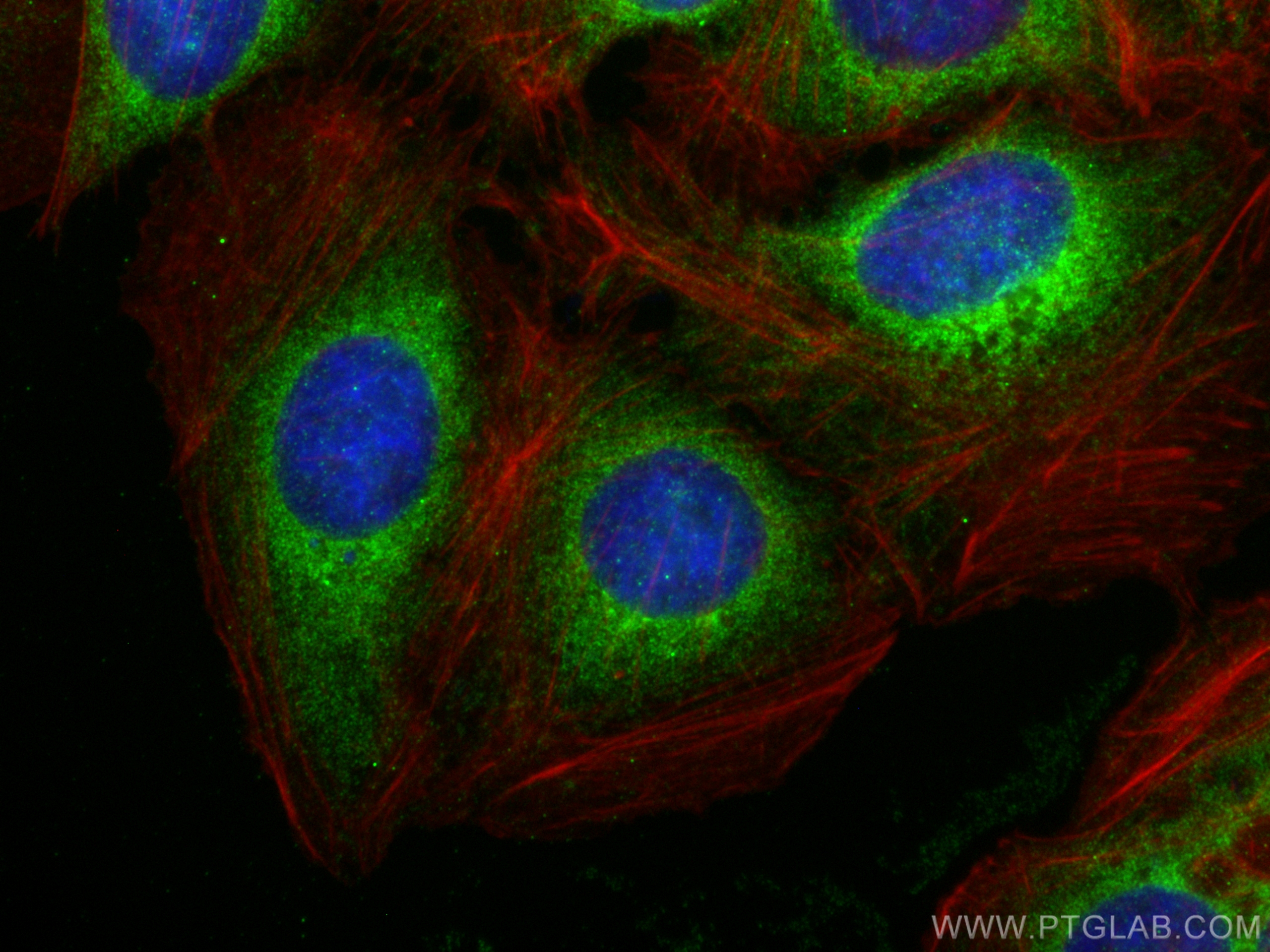 Immunofluorescence (IF) / fluorescent staining of U2OS cells using KATNAL2 Polyclonal antibody (17074-1-AP)