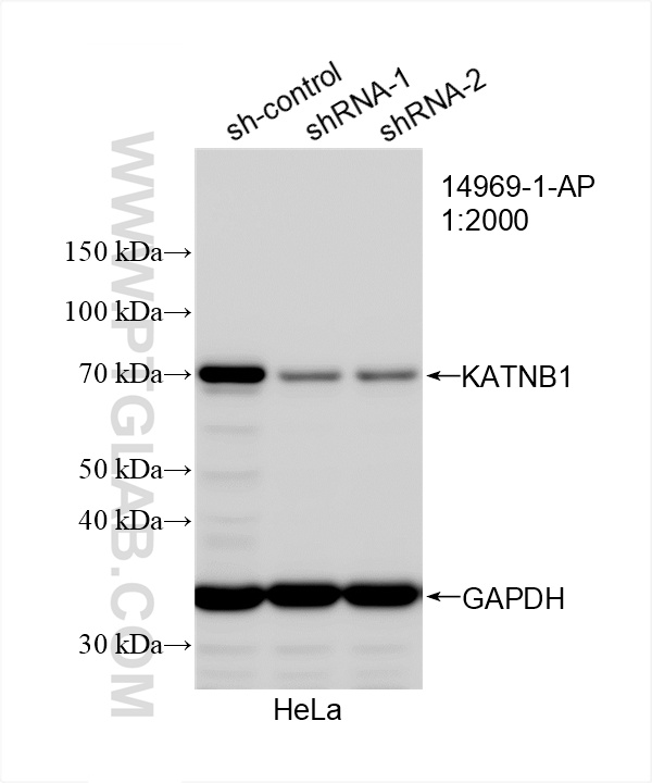 Western Blot (WB) analysis of HeLa cells using KATNB1 Polyclonal antibody (14969-1-AP)