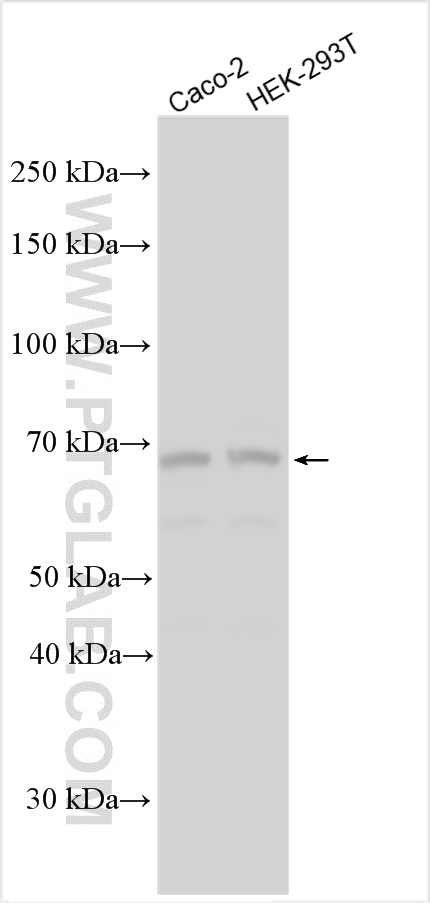 Western Blot (WB) analysis of various lysates using KBTBD11 Polyclonal antibody (31778-1-AP)