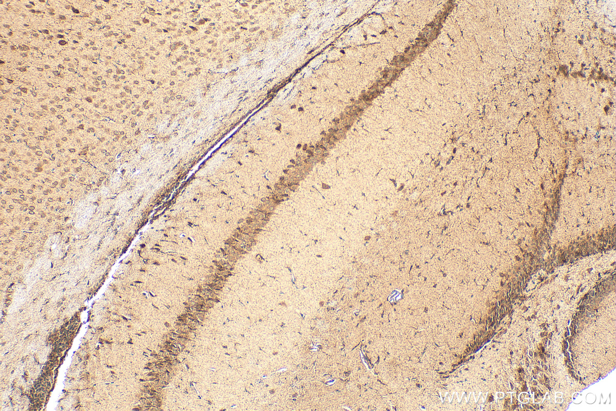 Immunohistochemistry (IHC) staining of mouse brain tissue using KCNA6 Polyclonal antibody (31900-1-AP)