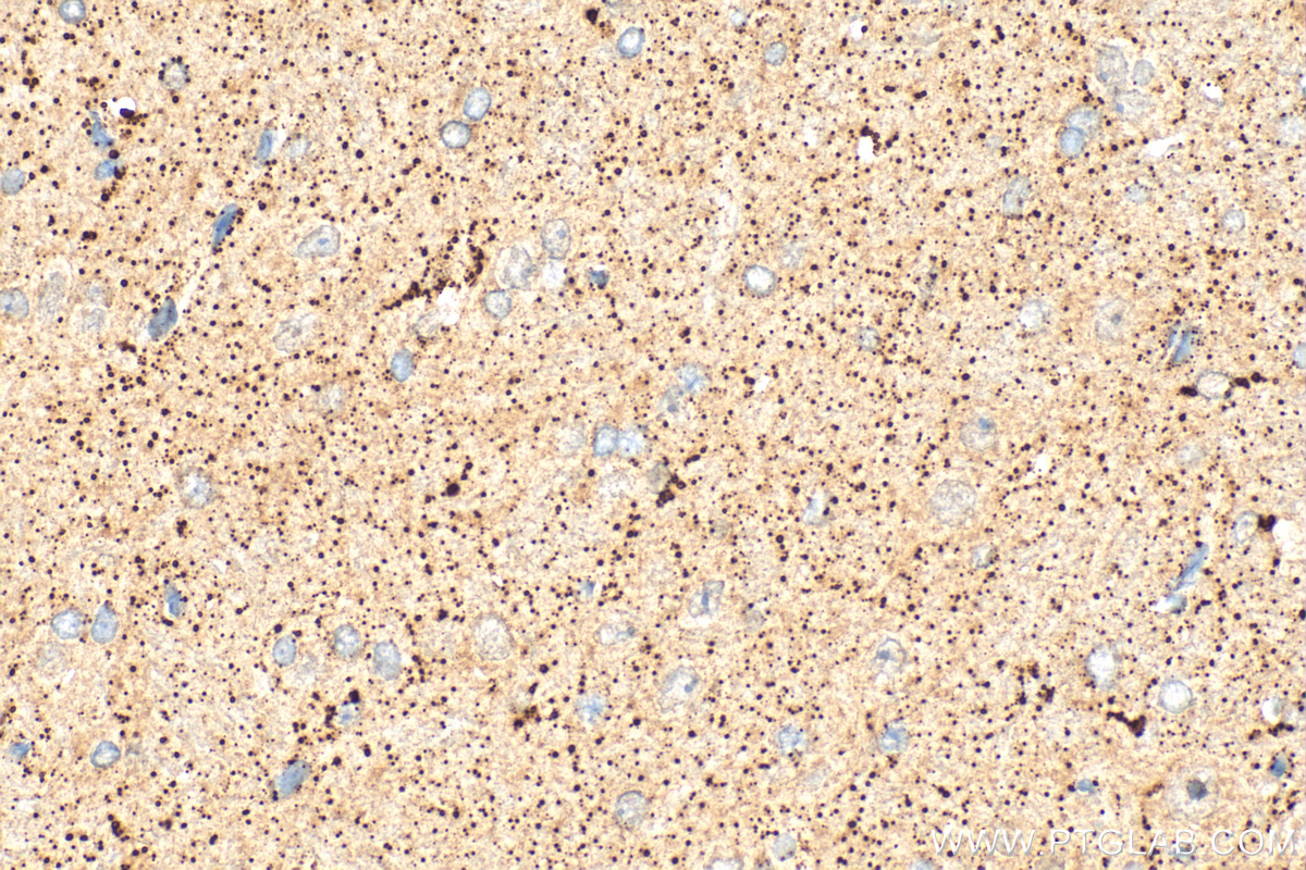 Immunohistochemistry (IHC) staining of rat brain tissue using KCNA6 Polyclonal antibody (31900-1-AP)
