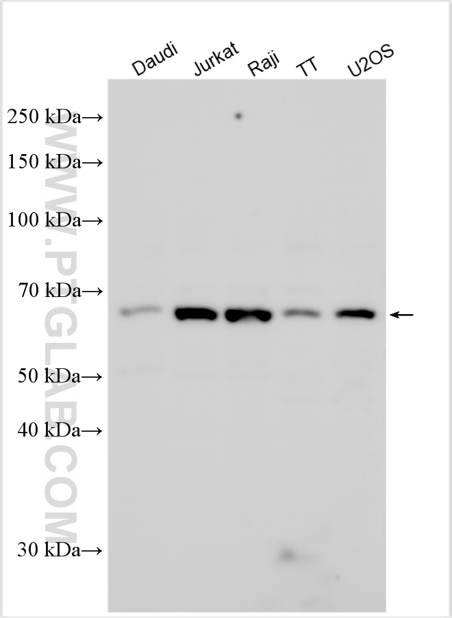 Western Blot (WB) analysis of various lysates using KCNA6 Polyclonal antibody (31900-1-AP)