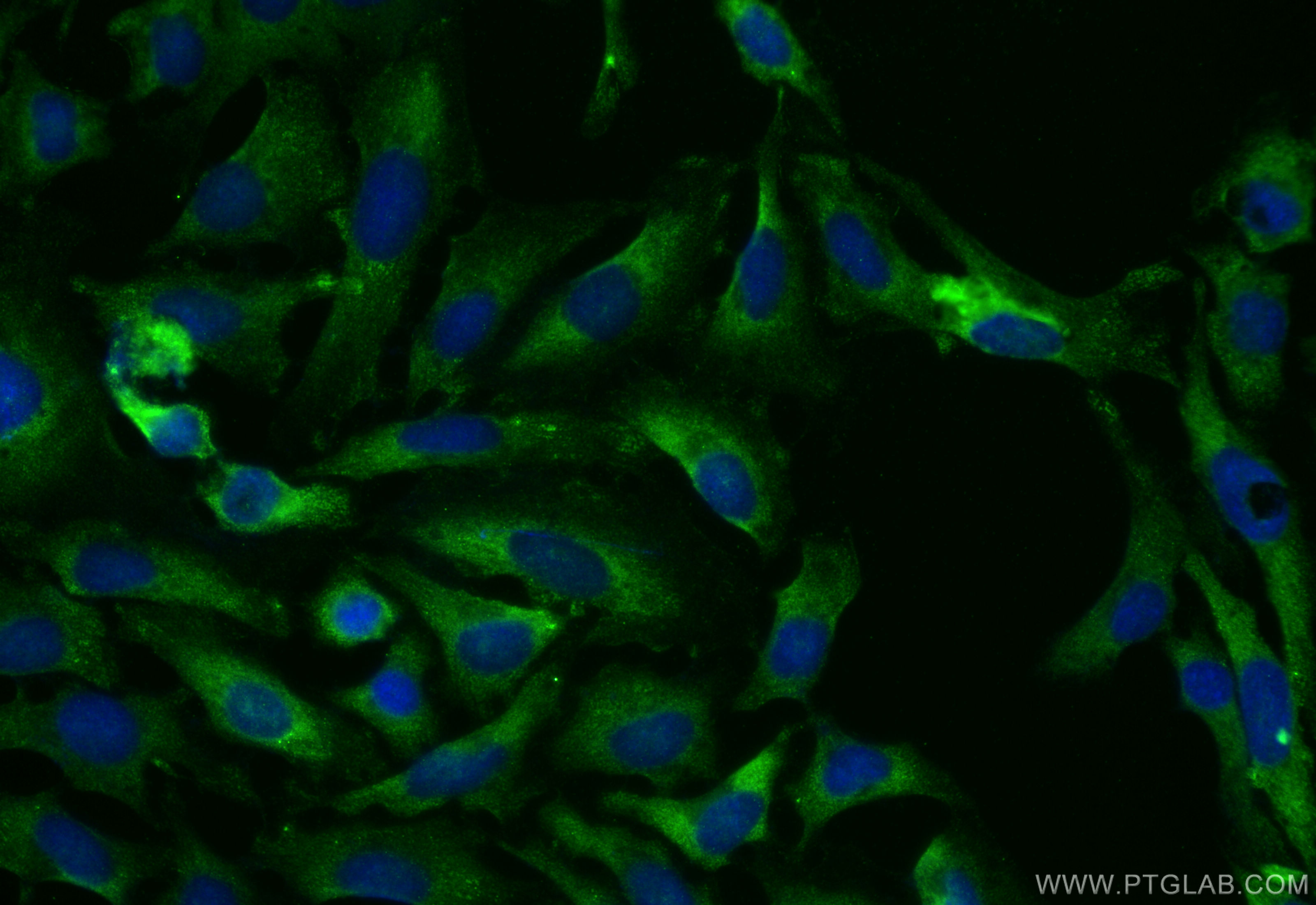 Immunofluorescence (IF) / fluorescent staining of HeLa cells using KCNAB1 Polyclonal antibody (14697-1-AP)