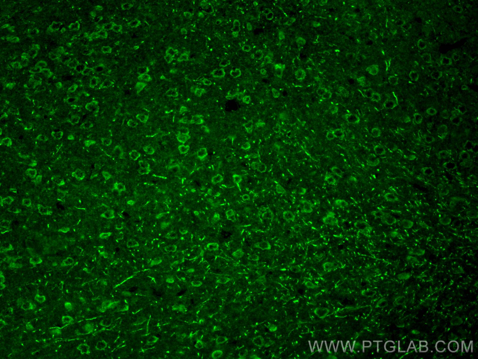 Immunofluorescence (IF) / fluorescent staining of mouse brain tissue using Kv4.2 Polyclonal antibody (21298-1-AP)