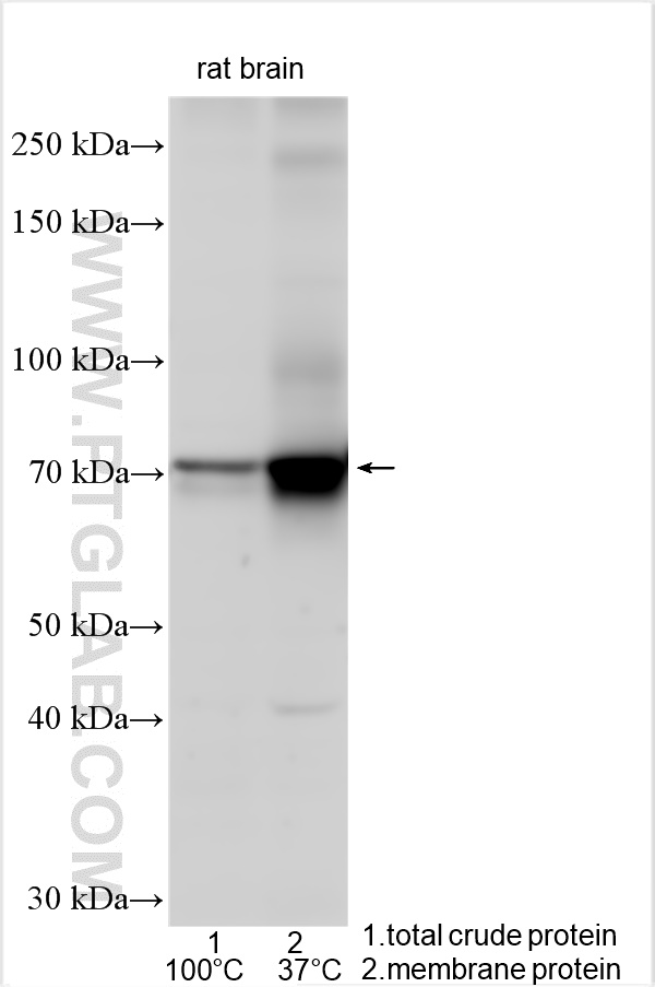 Western Blot (WB) analysis of various lysates using KCND3 Polyclonal antibody (25468-1-AP)