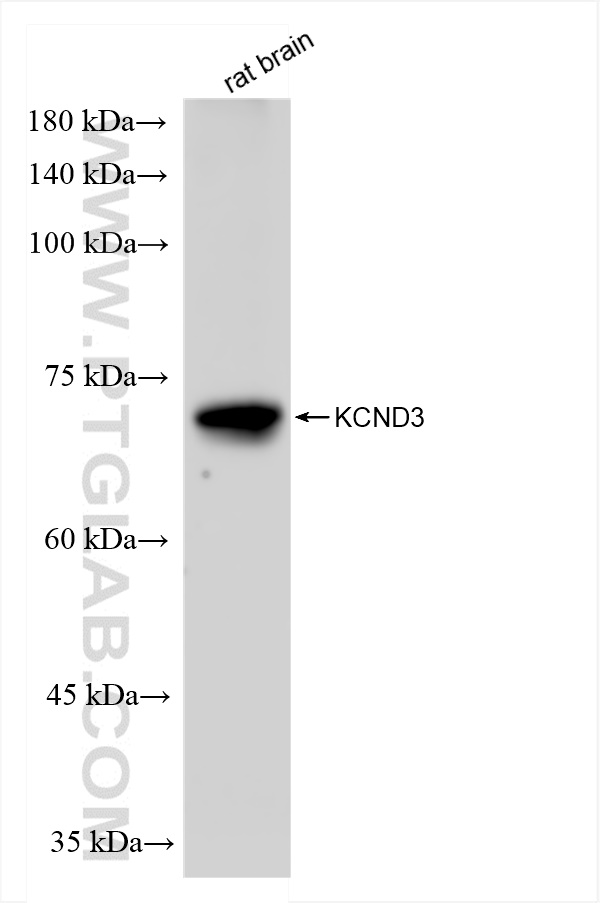 Western Blot (WB) analysis of rat brain tissue using KCND3 Recombinant antibody (83640-5-RR)