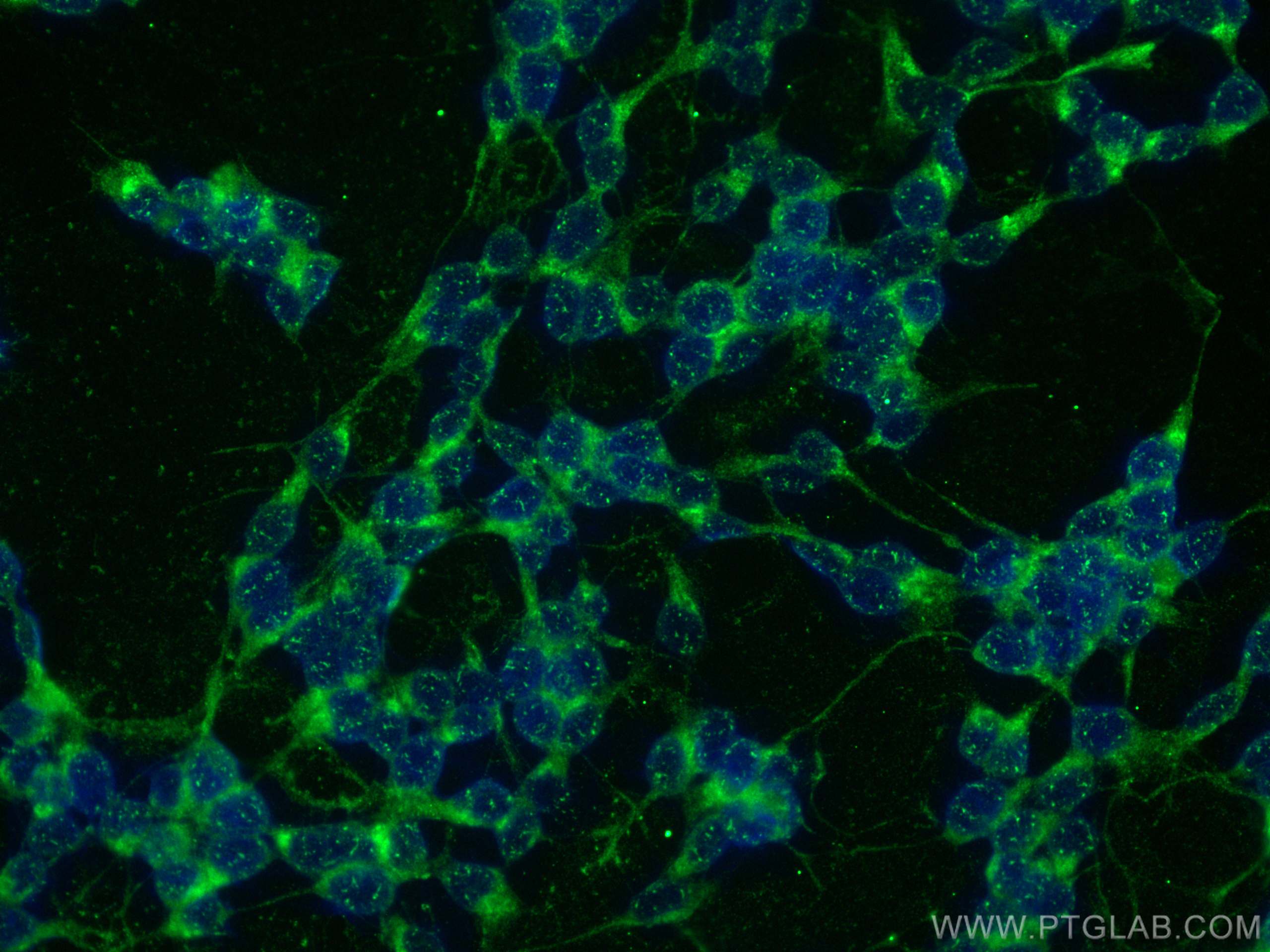 Immunofluorescence (IF) / fluorescent staining of SH-SY5Y cells using KCNIP3 Polyclonal antibody (12032-1-AP)