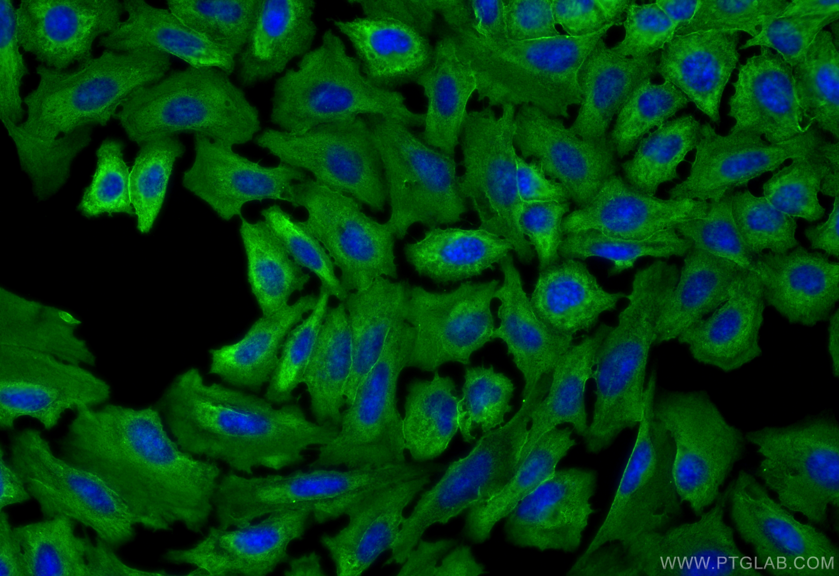 Immunofluorescence (IF) / fluorescent staining of U2OS cells using KCNQ2 Monoclonal antibody (66774-1-Ig)