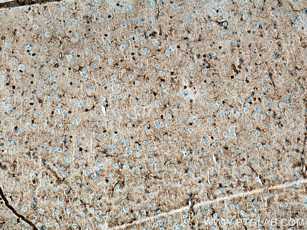 Immunohistochemistry (IHC) staining of mouse brain tissue using KCNQ2 Monoclonal antibody (66774-1-Ig)