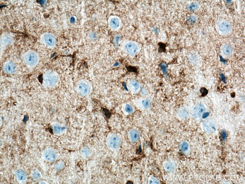 Immunohistochemistry (IHC) staining of mouse brain tissue using KCNQ2 Monoclonal antibody (66774-1-Ig)