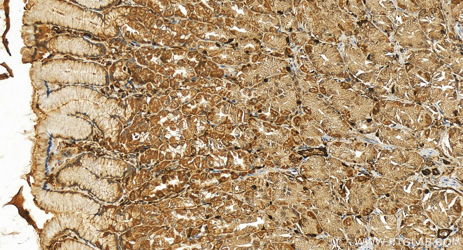 Immunohistochemistry (IHC) staining of human stomach tissue using KCTD12 Polyclonal antibody (15523-1-AP)