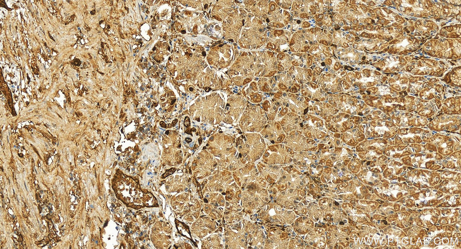 Immunohistochemistry (IHC) staining of human stomach tissue using KCTD12 Polyclonal antibody (15523-1-AP)